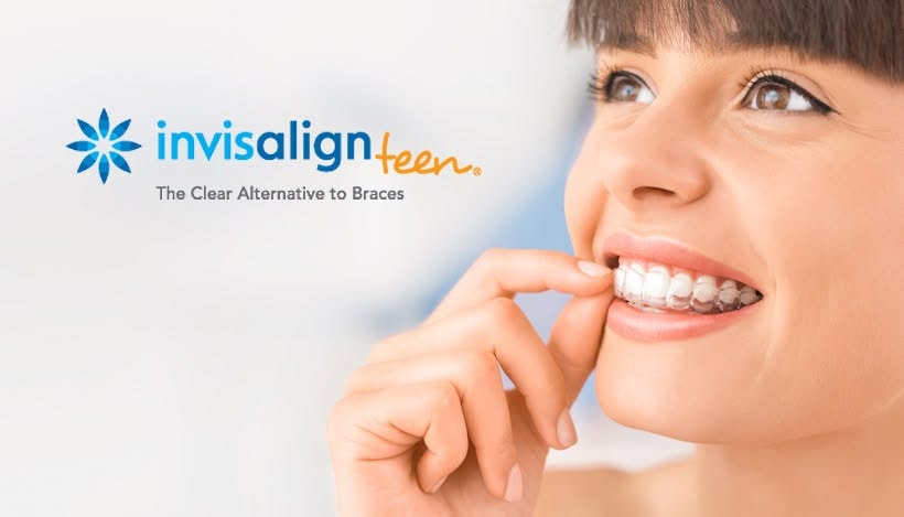 Invisalign Teen — The Clear Alternative to Braces